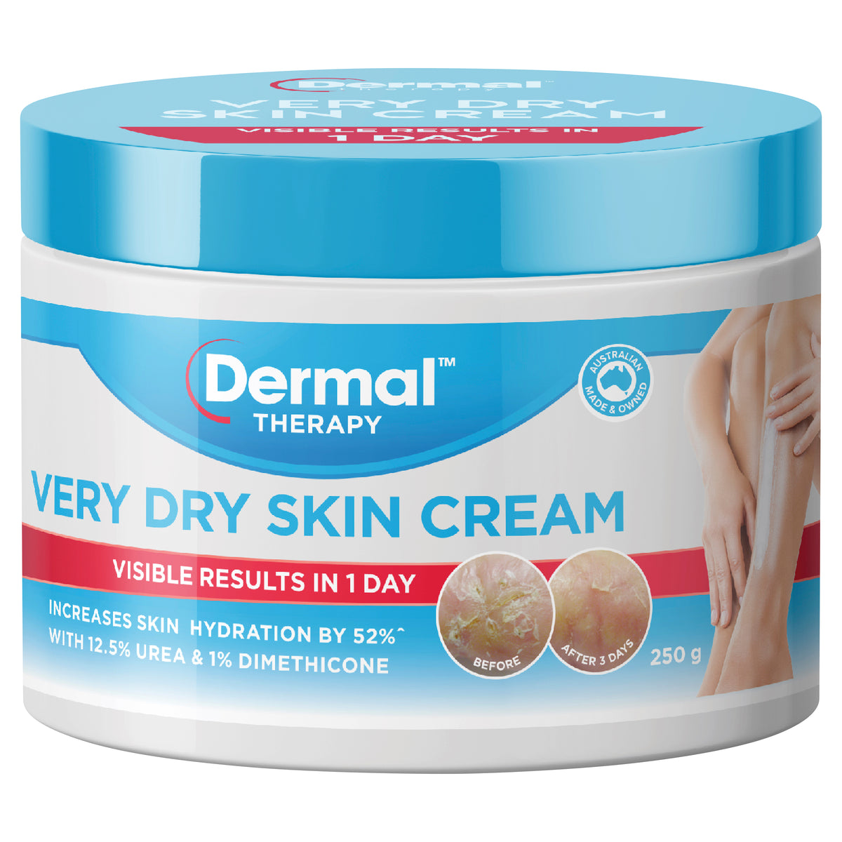 Dermal Thrpy V/Dry Skn Crm Tub 250g