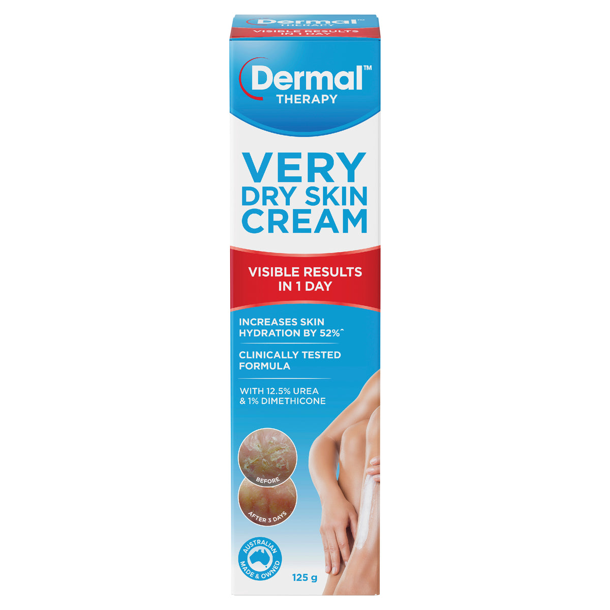 Dermal Thrpy V/Dry Skn Crm 125gm